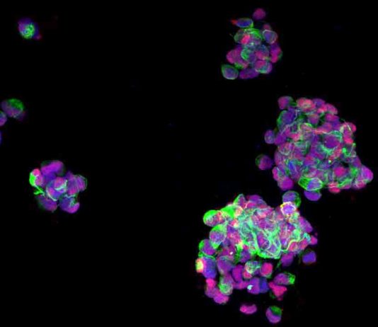 Investigadores del ISCIII e IDP Pharma validan una nueva molécula contra los tumores cerebrales Investigadores del ISCIII e IDP Pharma validan una nueva molécula contra los tumores cerebrales
