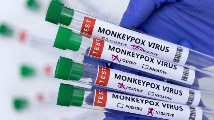 Ya son 14 los casos detectados de viruela del mono en Catalunya