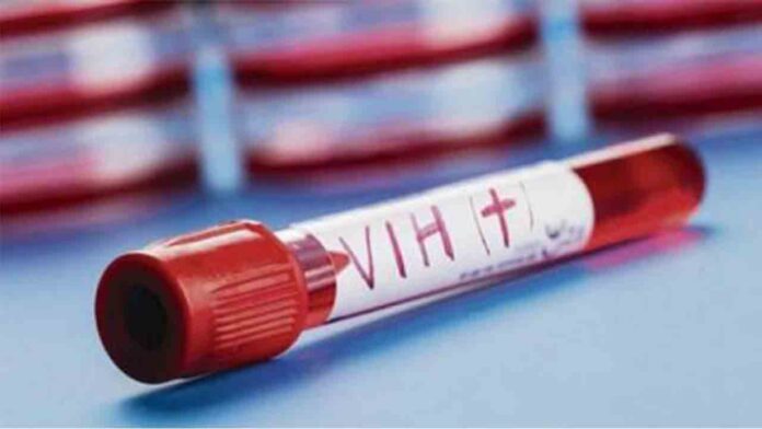 Cataluña registra un descenso del 20% de los diagnósticos en VIH