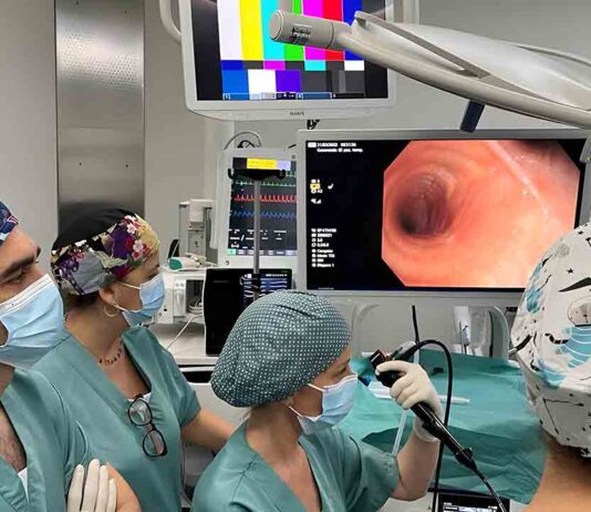 Una tecnología del Hospital de Sant Pau detecta el cáncer de pulmón en zonas hasta ahora inaccesibles Una tecnología del Hospital de Sant Pau detecta el cáncer de pulmón en zonas hasta ahora inaccesibles