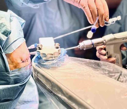El Hospital del Mar realiza la primera operación laser para tratar un tumor inoperable El Hospital del Mar realiza la primera operación laser para tratar un tumor inoperable