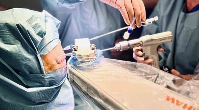 El Hospital del Mar realiza la primera operación laser para tratar un tumor inoperable El Hospital del Mar realiza la primera operación laser para tratar un tumor inoperable