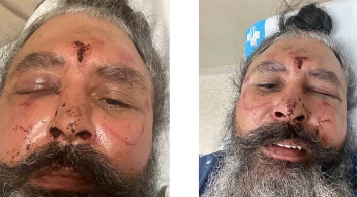 Buscan a un hombre que agredió y robó a un taxista en Cornellà Buscan a un hombre que agredió y robó a un taxista en Cornellà