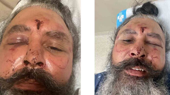 Buscan a un hombre que agredió y robó a un taxista en Cornellà