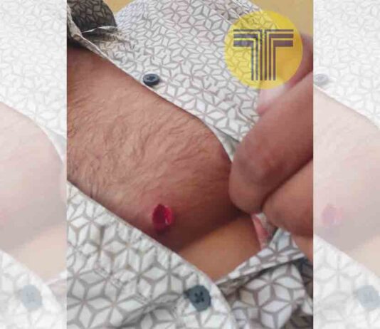 Apuñalan a un taxista en El Raval tras robarle y a un conductor de VTC por ayudarle Apuñalan a un taxista en El Raval tras robarle y a un conductor de VTC por ayudarle