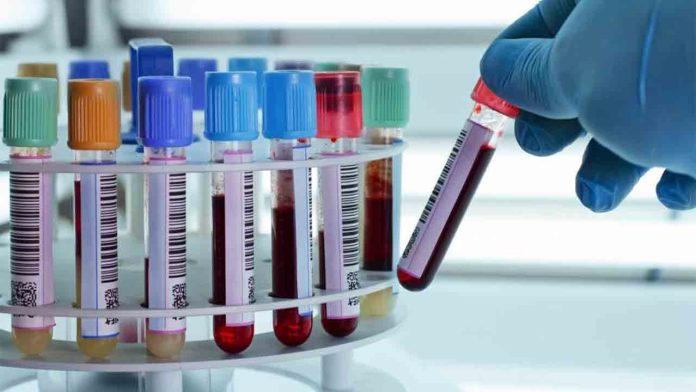 Un test en sangre pionero anticipa la evolución hacia el Alzhéimer Un test en sangre pionero anticipa la evolución hacia el Alzhéimer