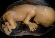 IQS e IDIBAPS desarrollan un sistema para sellar membranas en cirugía fetal IQS e IDIBAPS desarrollan un sistema para sellar membranas en cirugía fetal