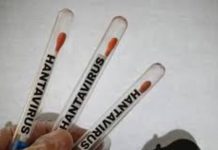 Sanidad descarta riesgo en Barcelona por un posible contacto de hantavirus Claves del hantavirus: origen, síntomas y formas de contagio