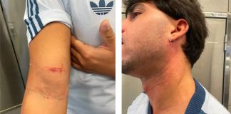 Asalto en la L2 del metro de: roban una cadena con valor sentimental a un joven Asalto en la L2 del metro de: roban una cadena con valor sentimental a un joven