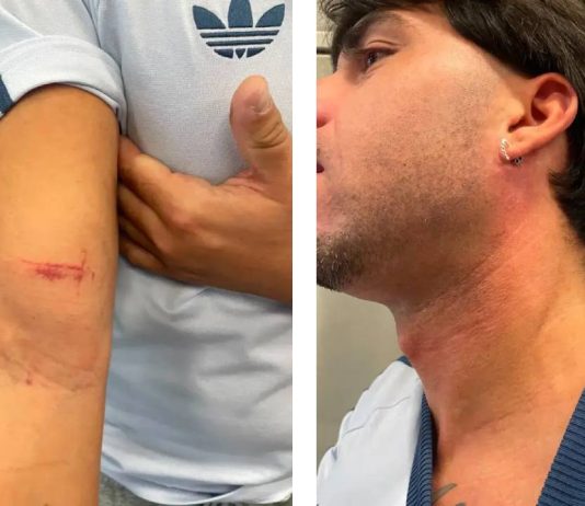 Asalto en la L2 del metro: roban una cadena con valor sentimental a un joven Asalto en la L2 del metro de: roban una cadena con valor sentimental a un joven