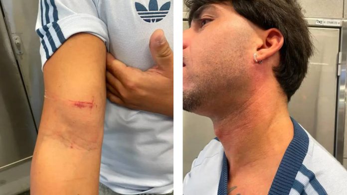Asalto en la L2 del metro de: roban una cadena con valor sentimental a un joven